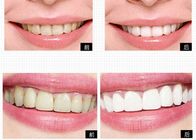 白くなる家の歯のための私用ロゴのパーソナル ケア プロダクト歯の漂白システム